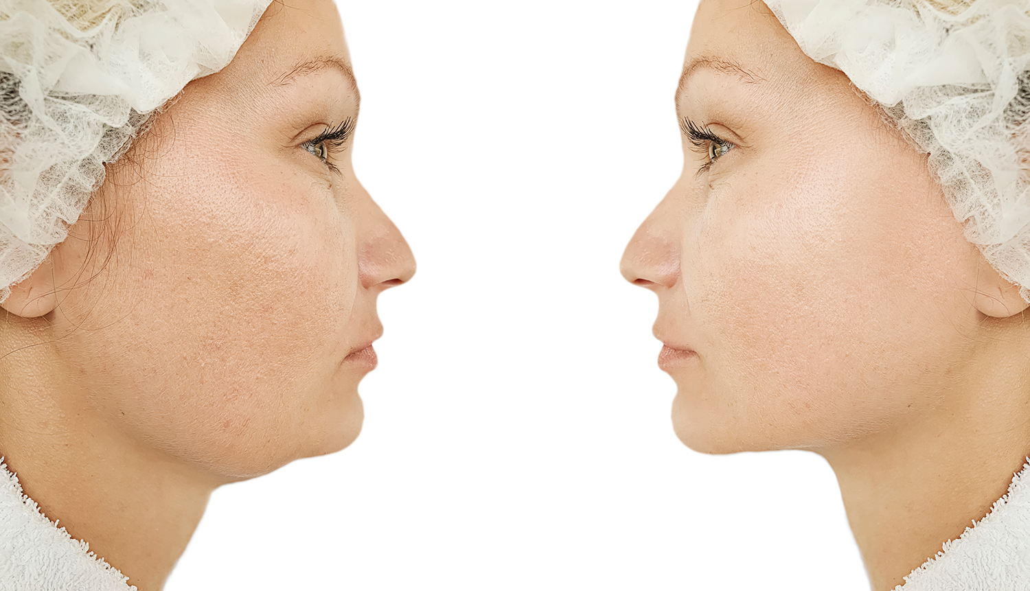 A mirror image of a woman, one side showing aged with one side looking younger.