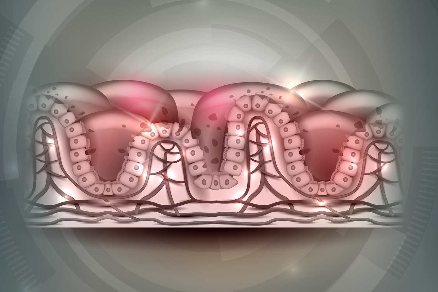 a diagram of villi reaction to gluten