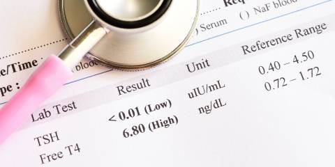 Abnormal thyroid hormone test result.