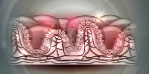a diagram of villi reaction to gluten